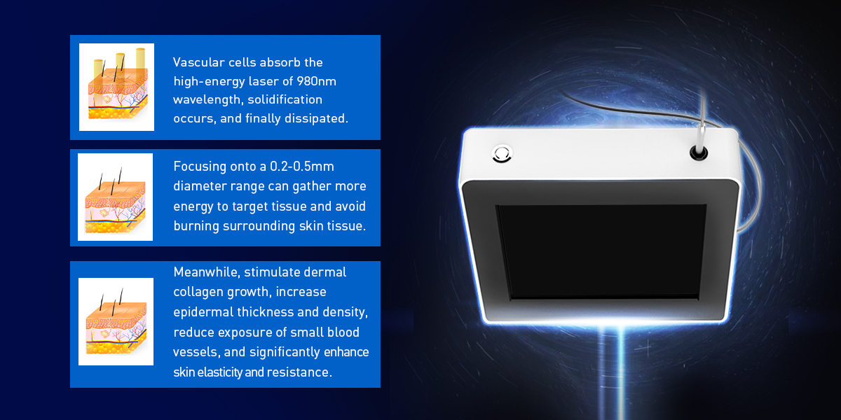 Macchina laser a diodi 980 nm 