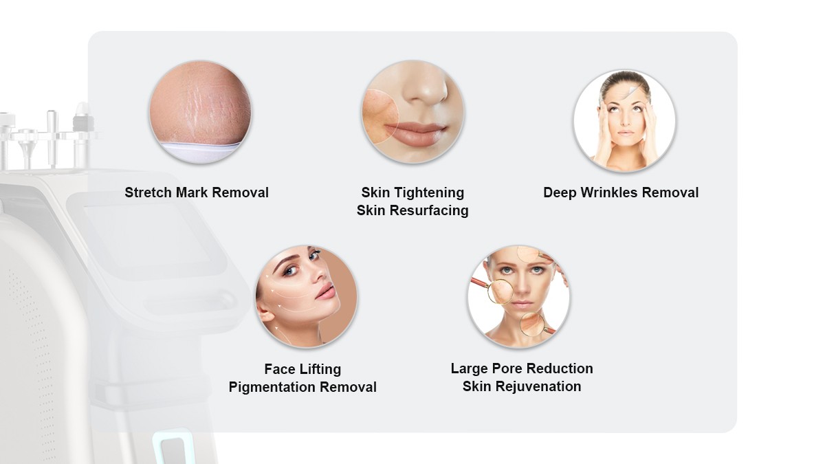 Macchina RF frazionata Microneedle