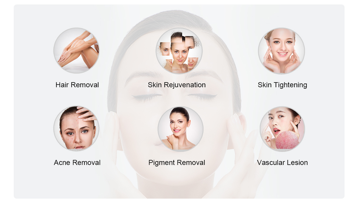 Macchina per la depilazione di rimozione dell'acne di rimozione dei capelli di DPL
