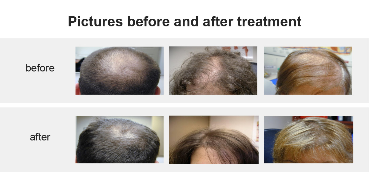  Prodotto Macchina per la depilazione laser a diodi Macchina per scolpire i capelli Ems Macchina per microneedling RF Vuoto Macchina per microneedling frazionario Macchina laser Nd Yag Macchina laser frazionale CO2 Macchina criogenica ad aria Macchina per la ricrescita dei capelli laser Macchina per dimagrire criolipolisi Macchina DPL Contattaci  Alex@sanolasers.com  +86 15321516360  +86 15321516360  Room 7-201,No.1,Caida 3rd Street, Nancai Town, Shunyi District, Beijing, China macchina per terapia laser per capelli macchina per terapia laser per capelli macchina per terapia laser per capelli macchina per terapia laser per capelli terapia laser per capelli macchina macchina di terapia dei capelli laser macchina di terapia dei capelli laser macchina di terapia dei capelli laser macchina di terapia dei capelli laser macchina di terapia dei capelli laser macchina di terapia dei capelli laser macchina di terapia dei capelli laser macchina di terapia dei capelli laser 