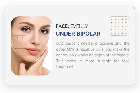 macchina microneedling professionale RF