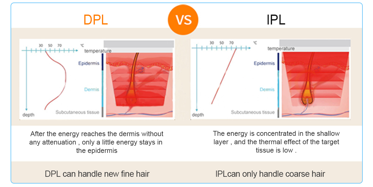 Macchina per la depilazione di rimozione dell'acne di rimozione dei capelli di DPL